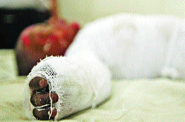 মাদকের টাকা না পেয়ে স্ত্রীর গায়ে আগুন, রিজিয়ার মৃত্যু
